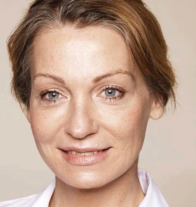 Visage après Skinbooster : texture plus homogène, ridules atténuées et teint plus lumineux