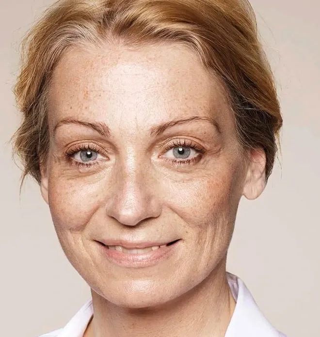 Visage avant Skinbooster : texture irrégulière, ridules marquées et teint terne