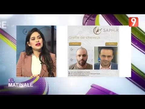 El Matinale — Techniques modernes en greffe — Ettasia TV
